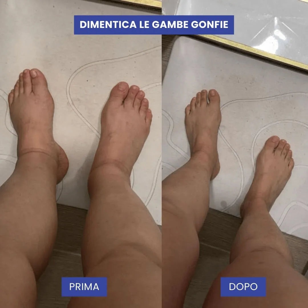 CALZE LYSEA A COMPRESSIONE CON CERNIERA PREMIUM